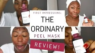 Beauty Review | The Ordinary AHA 30% + BHA 2% Peeling Solution  - Dark Skin