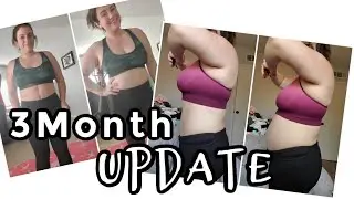 3 Month Tummy Tuck Update TUMMY TUCK JOURNEY | Swelling Bloating And Sore