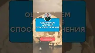 Оцениваю древние методы лечения боли от 1 до 10 | Алголог с юмором