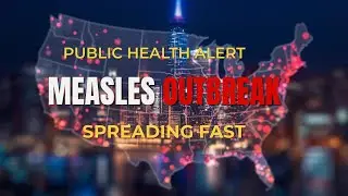 Measles Outbreak Sparks Public Health Emergency Fears | What They’re Not Telling You