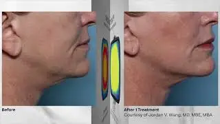 XERF USA Video