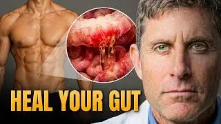 Top Ten Foods To Heal Leaky Gut
