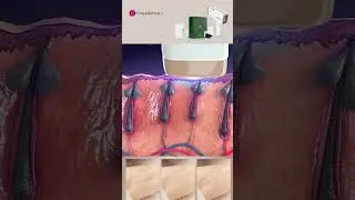 #e3 #laser #epilator #ipl #shaving #ipllaserhairremoval #ليزر #beauty #kinseibeauty #explore