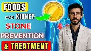 Top Foods for Kidney Stone Prevention | Science vs Myths | Myth vs Fact | Eat Smart 60+