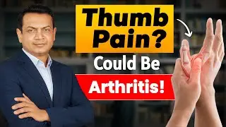Thumb Pain Could Be Arthritis! Don&rsquo;t Ignore These Early Signs of 1st CMC Joint Trouble