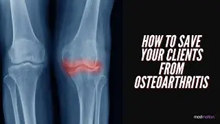 How to Save Your Clients From Osteoarthritis