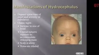 Chapter 14 - The NB with Perinatal injury or Congenital Malformation
