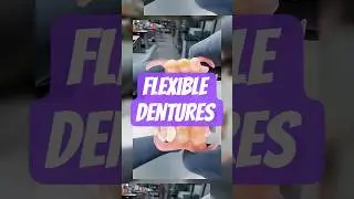 Why Flexible Dentures Are the Future of False Teeth