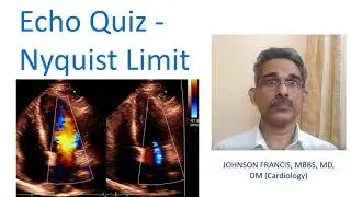 Echo Quiz - Nyquist Limit
