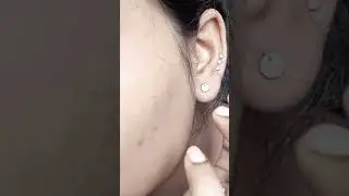 #fake ear 👂🏾 parsing hack# fake hack 🥴😂#viral#hackshorts