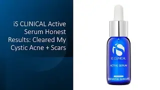 iS CLINICAL Active Serum Honest Results: Cleared My Cystic Acne + Scars