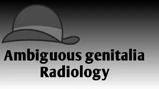 Approach to ambiguous genitalia - Radiology