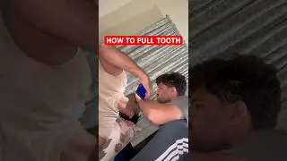 How to Pull a Loose Tooth at Home 😬 #Shorts #viralvideo 🦷
