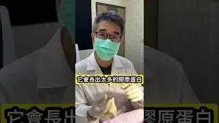 這種 #凹疤 別打 #皮秒 #皮膚科醫師 説 這招不通又有效#吳仁欽皮膚科診所 #屏東醫美 #567 #屏東微整 #疤痕 #二氧化碳雷射 #微針 #膠原蛋白增生劑 #皮下剝離 #汽化雷射 #飛梭