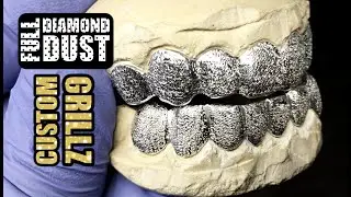 Full Diamond Dust Custom Grillz 925 Silver - blingcartel.com