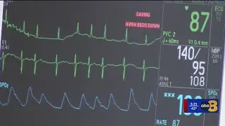 UVA cardiologist raises awareness about pericarditis, a rare heart condition