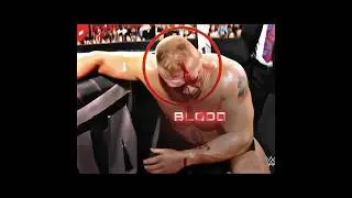 Brock Lesnar Took Revange on Roman Reigns😱|&bull;&bull;EDIT&bull;&bull;~ Dare ( SLOWED )#shorts #wwe #brocklesnar .