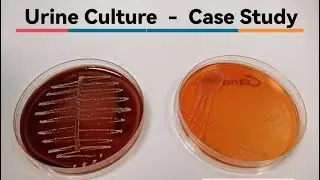 Urine Culture Case - (Staph, or Candida, or E. coli) Pathogen Identification شرح عملي مزرعة البول