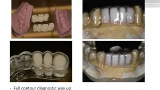 Digital Treatment Planning Image Acquisition