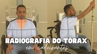 Raio X de tórax AP+ perfil em pacientes cadeirantes
