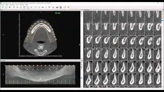 Aula 27 - Imaging Studio - Geração de Documentações