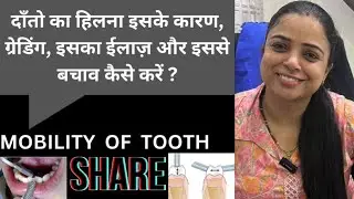 Mobility of tooth. Its causes, grading, treatment and how we can prevent it.