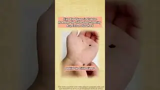 Remember the Three Sugar-Lowering acupoints on Your hand.#bloodsugarbalance #tcm #highbloodsugar