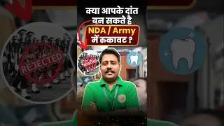क्या आपके दांत बन सकते है NDA / Army में रुकावट ? #nda #dreamersnda #shorts #medicaltest #defence