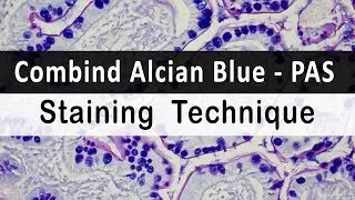 Combind Alcian blue PAS  Staining  Technique