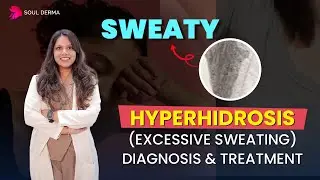 Excessive Sweating Explained | Causes & Treatments for Hyperhidrosis