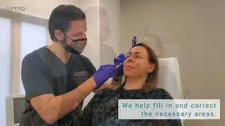 Dr. Sajic Performs a Dermal Filler Correction