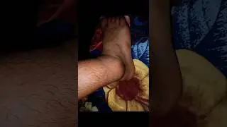 Ankle Ligament Tear to Functional Movement 💪 #bijli #reellovers #rehabilitation