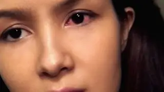 WHAT IS WRONG WITH MY EYE??!