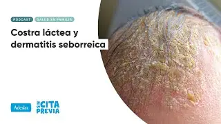 Costra láctea y dermatitis seborreica | Ep. 04x40