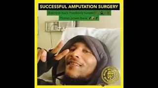 Successfully got my toe amputated #amputation #surgery #paralysis #hospital
