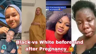 Tedo Comedy-How Pregnancy Transformers white vs black women😂. (Pregnancy will humble you)