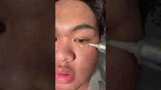 GOODBYE FINE LINES, RETINOL #skincare #kbeauty #fineline #celimax #koreanskincare #retinol #viral