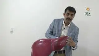 Hydatid disease - Dr P Senthilnathan | GEM Hospital | Liver Diseases | Hydatid Cyst