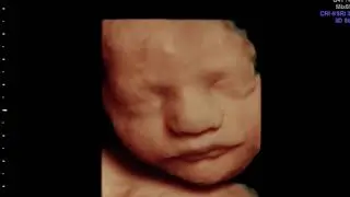 Unbelievable 4D 3D HD Ultrasound