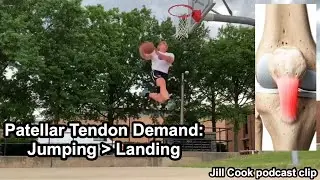 Jumper's Knee: Jumping is more stressful than Landing via Jill Cook (Fix Patellar Tendon Pain)
