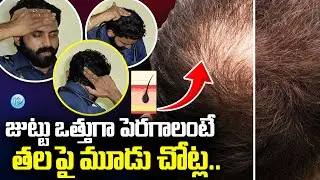 3 Simple Exercises on Scalp to Improve Blood Circulation and Prevent Hair Lose | Doctor Hair Tips