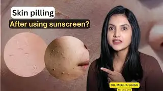 Why Your Sunscreen is Peeling & How to Fix It | Simple Skincare Tips I Dr. Megha Pundir Singh