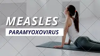 MEASLES | MEASLES VACCINE |OPEN VIAL POLICY