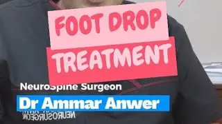 Foot drop treatment