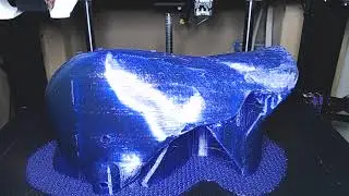 3D Printed Ankle Foot Orthotic