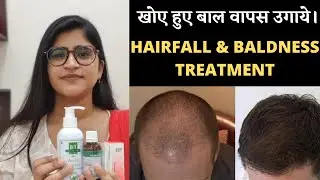 Hairfall And Baldness Treatment।।खोए हुए बाल वापस उगाये।।Hair regrowth medicines||