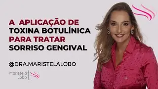 A APLICAÇÃO DE TOXINA BOTULÍNICA PARA TRATAR SORRISO GENGIVAL