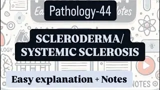 Scleroderma/ Systemic sclerosis |Pathology-44 |With easy explanation and handwritten notes.