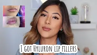 I GOT HYLURON LIP FILLERS (NO NEEDLES)