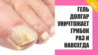 Ирунин отзывы форум грибок ногтей ❕ Уход ногами грибке 👌